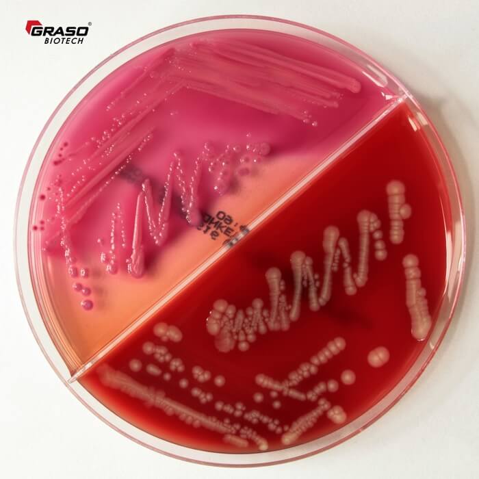 MacConkey_Columbia E.coli Graso 360