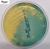 CLED Agar (Cystine Lactose Electrolyte Deficient) (111)